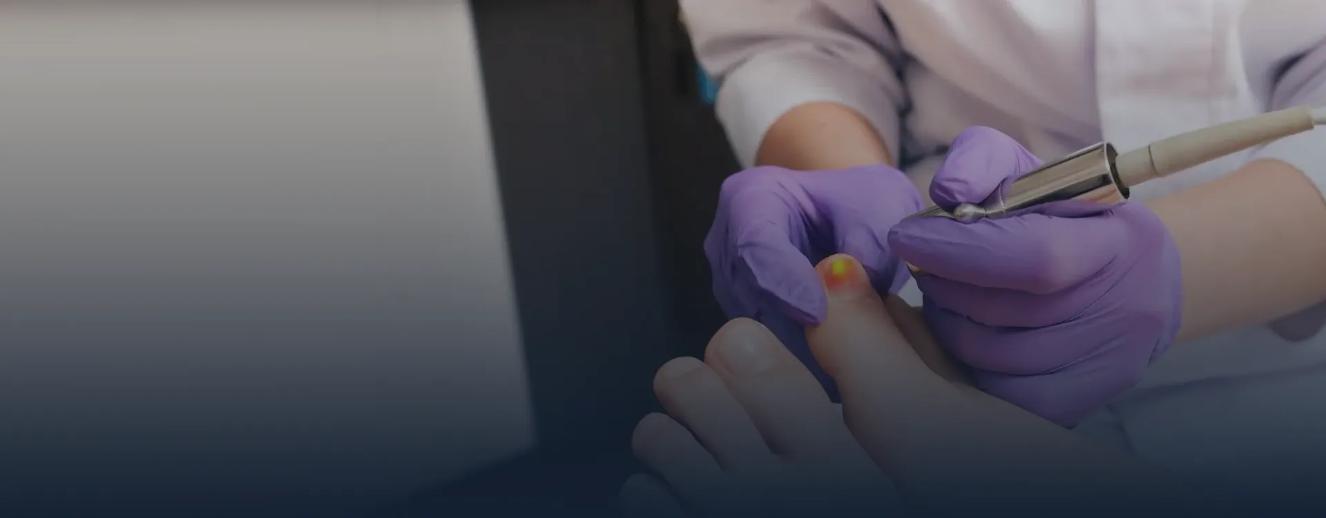 podologia laserterapia